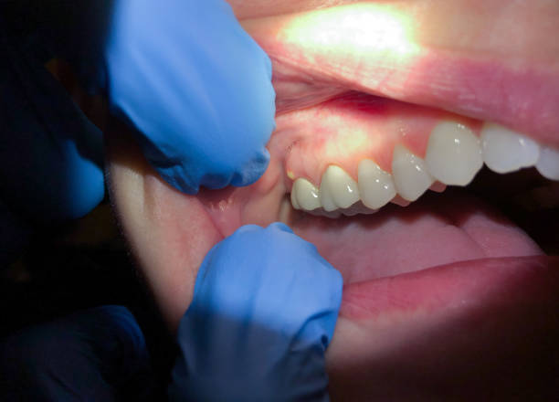 Best Dentist for Severe Toothache  in Omak, WA
